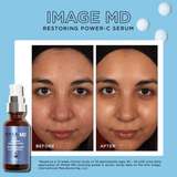Image Skincare MD Restoring Power C Serum