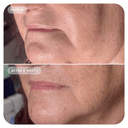 Image Skincare VOL.U.LIFT GLP-1 4D Skin Rebound Complex 2oz / 57ml