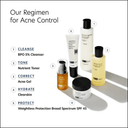 PCA Skin Acne Gel 1oz / 30ml
