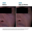 SkinCeuticals P-TIOX Cream 1.7oz / 50ml