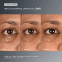 Dermalogica Smart Eye Density Undereye Serum 0.5oz / 15ml