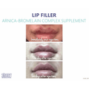 Silagen Arnica-Bromelain Complex – 28 Capsules