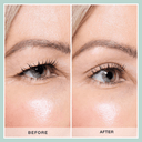 Contours Rx Lids By Design Assortment Pack (80 Count)