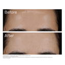 EltaMD UV Clear Blemish-Prone & Oil-Balancing 1.7oz/ 50ml