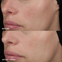 Image Skincare Image MD Barrier Repair Recovery Balm