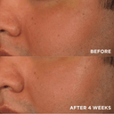 Image Skincare Brightening Boost Kit