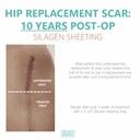 Silagen Ab/Extremity Clear Silicone Strip - 2" x 8"