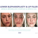 Silagen Arnica-Bromelain Complex – 28 Capsules