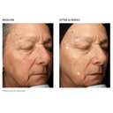 PCA Skin MGF Age Renewal Cream