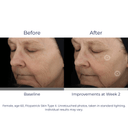 SkinMedica TNS Advanced+ Serum 1oz / 30ml