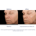 SkinMedica TNS Advanced+ Serum 1oz / 30ml