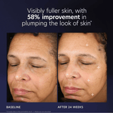 PCA Skin Pro-Max Age Renewal 1oz / 30ml