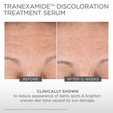 Glytone TranEXamide Discoloration Treatment Serum 1oz