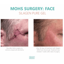 Silagen 100% Pure Silicone Gel