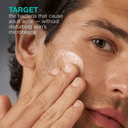 Dermalogica Acne Biotic Moisturizer 1.7oz / 50ml