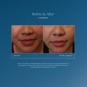 iS Clinical Daily Dynamic Hydrator 1.7oz / 50ml