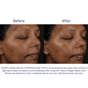 SkinMedica HA5 Hydra Collagen Water Burst Moisturizer 1.7oz / 50ml
