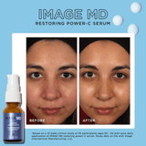 Image Skincare MD Restoring Power C Serum