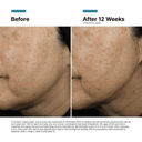 SkinCeuticals A.G.E. Interrupter Ultra Serum 1oz / 30ml